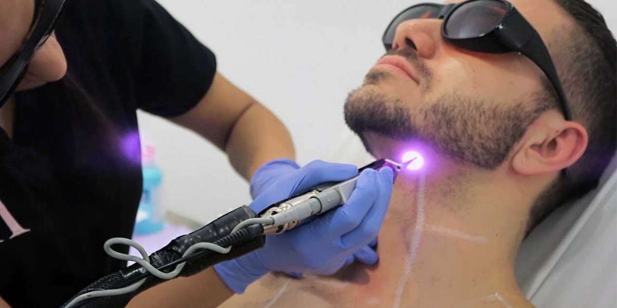 Laser hair removal treatment cost